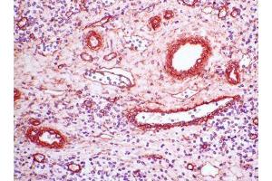 Image no. 1 for anti-Collagen, Type IV (COL4) antibody (ABIN481663) (Collagen IV 抗体)
