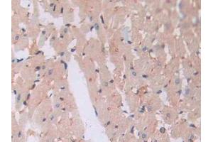 Detection of PANX1 in Rat Cardiac Muscle Tissue using Polyclonal Antibody to Pannexin 1 (PANX1)