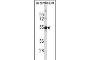 Western blot analysis in mouse cerebellum tissue lysates (35ug/lane). (TSPYL5 抗体  (C-Term))