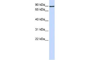 WB Suggested Anti-ATMIN Antibody Titration:  0. (ATM Interactor 抗体  (Middle Region))