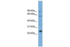 BCL7A antibody used at 1 ug/ml to detect target protein. (BCL7A 抗体  (Middle Region))