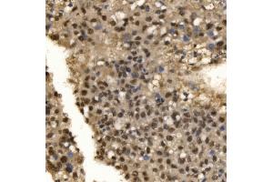 IHC analysis of CPSF6 using anti-CPSF6 antibody (ABIN7601898).