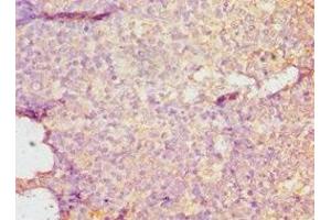 Immunohistochemistry of paraffin-embedded human tonsil tissue using ABIN7149695 at dilution of 1:100 (DMP1 抗体  (AA 254-513))