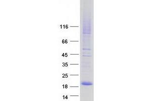 Western Blotting (WB) image for CKLF-Like MARVEL Transmembrane Domain Containing 7 (CMTM7) (Transcript Variant 2) protein (Myc-DYKDDDDK Tag) (ABIN2712902)