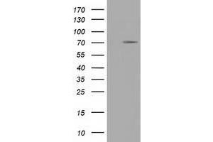 Western Blotting (WB) image for anti-Tripartite Motif Containing 2 (TRIM2) (AA 1-100), (AA 645-744) antibody (ABIN1490544) (TRIM2 抗体  (AA 1-100, AA 645-744))