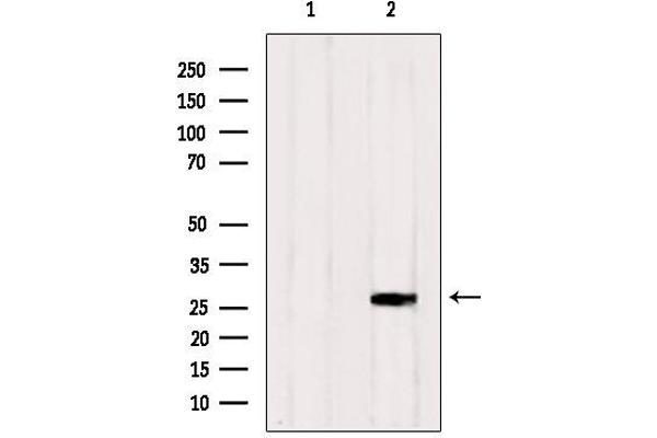 RAB33A 抗体  (Internal Region)
