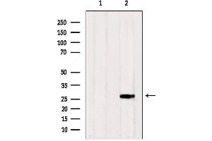 Western blot analysis of extracts from HepG2, using RAB33A Antibody. (RAB33A 抗体  (Internal Region))