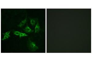 Immunofluorescence analysis of A549 cells, using GNRHR antibody. (GNRHR 抗体  (Internal Region))