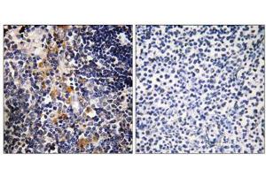 Immunohistochemistry analysis of paraffin-embedded human thymus gland tissue using MCPH1 antibody. (MCPH1 抗体  (N-Term))