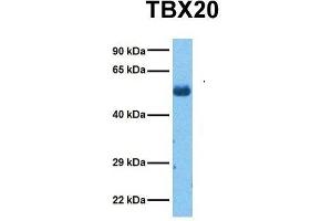 Host:  Rabbit  Target Name:  TBX20  Sample Tissue:  Human Lung Tumor  Antibody Dilution:  1. (TBX20 抗体  (Middle Region))