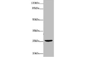Western blot All lanes: NEGR1 antibody at 4 μg/mL + U87 whole cell lysate Secondary Goat polyclonal to rabbit IgG at 1/10000 dilution Predicted band size: 39, 25 kDa Observed band size: 25 kDa (NEGR1 抗体  (AA 1-196))