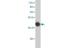 Western Blot detection against Immunogen (36. (GABBR1 抗体  (AA 52-151))