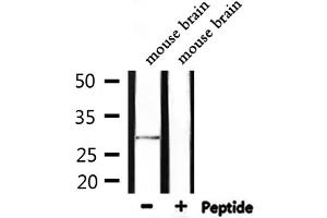 Western blot analysis of extracts from mouse brain, using SENP8 Antibody. (SENP8 抗体  (C-Term))