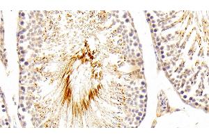 Immunohistochemistry (IHC) image for anti-Hepatitis A Virus Cellular Receptor 1 (HAVCR1) (AA 22-235) antibody (ABIN7432601)