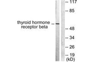 Western blot analysis of extracts from LOVO cells, using Thyroid Hormone Receptor beta Antibody. (THRB 抗体  (AA 11-60))
