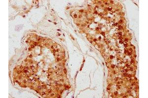IHC image of ABIN7158634 diluted at 1:400 and staining in paraffin-embedded human testis tissue performed on a Leica BondTM system. (Ly6k 抗体  (AA 18-138))