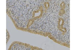 ABIN6279103 at 1/100 staining Human uterus tissue by IHC-P. (AKR1C1 抗体)