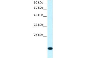 WB Suggested Anti-RPS16 Antibody Titration:  1. (RPS16 抗体  (N-Term))