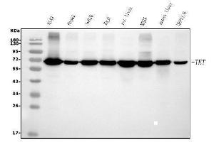 Western blot analysis of Transketolase/TKT using anti-Transketolase/TKT antibody (ABIN7598958).