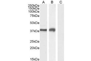 ABIN185571 (2µg/ml) staining of Jurkat (A), MOLT4 (B) and negative control A431 (C) cell lysate (35µg protein in RIPA buffer). (TIM3 抗体  (Internal Region))