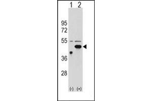 Western blot analysis of ETNK2 (arrow) using ETNK2 Antibody (N-term) Cat. (Ethanolamine Kinase 2 抗体  (N-Term))