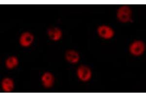 ABIN6267250 staining 293 by IF/ICC.