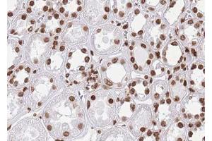 ABIN6268808 at 1/100 staining human kidney tissue sections by IHC-P. (HNRNPL 抗体  (N-Term))