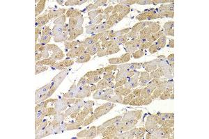 Immunohistochemistry of paraffin-embedded Rat heart using FIS1 antibody at dilution of 1:100 (x400 lens). (Fission 1 抗体)