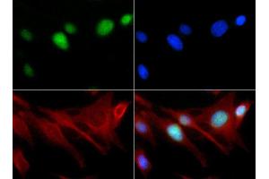 Fluorescence Microscopy (FM) image for anti-Histone 3 (H3) (H3K18me) antibody (ABIN5706754)
