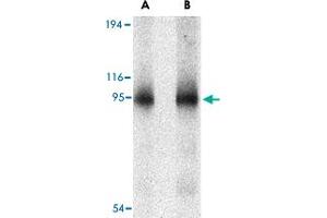 Western blot analysis of CD180 in human spleen tissue lysate with CD180 polyclonal antibody  at (A) 0. (CD180 抗体  (N-Term))