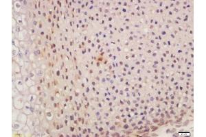 Formalin-fixed and paraffin embedded mouse embryo labeled with Anti-SUFU/Suppressor of Fused Polyclonal Antibody, Unconjugated  at 1:200 followed by conjugation to the secondary antibody and DAB staining (SUFUH 抗体  (AA 433-484))