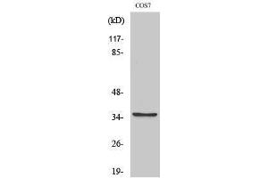 Western Blotting (WB) image for anti-Post-GPI Attachment To Proteins 1 (PGAP1) (Internal Region) antibody (ABIN3183562) (PGAP1 抗体  (Internal Region))