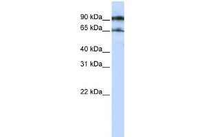 WB Suggested Anti-ATG9A Antibody Titration:  0. (ATG9A 抗体  (Middle Region))