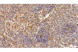 Immunohistochemistry (IHC) image for anti-Clusterin (CLU) (AA 226-447) antibody (ABIN7426742)