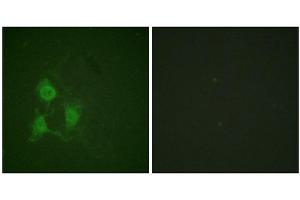 Immunofluorescence staining of methanol-fixed A549 cells using PKA α/β CAT (Phospho-Thr197) Antibody. (PRKACA 抗体  (pThr197))
