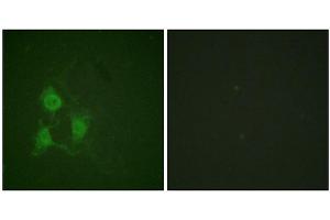 Immunofluorescence staining of methanol-fixed A549 cells using PKA α/β CAT (Phospho-Thr197) Antibody.