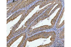 IHC analysis of SPATA18 using anti-SPATA18 antibody (ABIN7601020).