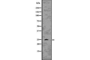 Western blot analysis of RHOQ using COLO205 whole  lysates. (RHOQ 抗体  (Internal Region))