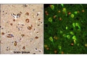 (LEFT)Formalin-fixed and paraffin-embedded human brain tissue reacted with ANXA7 Antibody (Center), which was peroxidase-conjugated to the secondary antibody, followed by DAB staining. (Annexin VII 抗体  (AA 329-356))