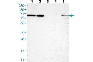 Western blot analysis of Lane 1: RT-4, Lane 2: U-251 MG, Lane 3: Human Plasma, Lane 4: Liver, Lane 5: Tonsil with HCFC2 polyclonal antibody  at 1:250-1:500 dilution. (HCFC2 抗体)