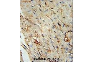 SCAR5 Antibody (C-term) (ABIN653999 and ABIN2843936) immunohistochemistry analysis in formalin fixed and paraffin embedded human skeletal muscle followed by peroxidase conjugation of the secondary antibody and DAB staining. (ZNF592 抗体  (C-Term))