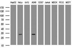 Image no. 2 for anti-Inhibitor of Growth Family, Member 2 (ING2) antibody (ABIN1498886) (ING2 抗体)