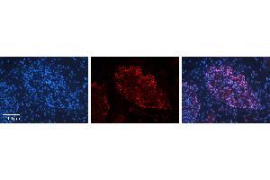 Rabbit Anti-BUD31 Antibody   Formalin Fixed Paraffin Embedded Tissue: Human Testis Tissue Observed Staining: Nucleus in spermatogonia and spermatocytes Primary Antibody Concentration: 1:100 Other Working Concentrations: N/A Secondary Antibody: Donkey anti-Rabbit-Cy3 Secondary Antibody Concentration: 1:200 Magnification: 20X Exposure Time: 0. (BUD31 抗体  (N-Term))