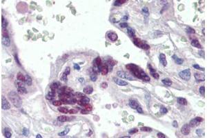 Human Placenta (formalin-fixed, paraffin-embedded) stained with MORF4L1 antibody ABIN462283 followed by biotinylated anti-goat IgG secondary antibody ABIN481715, alkaline phosphatase-streptavidin and chromogen. (MORF4L1 抗体  (AA 2-14))