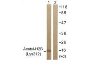 Western blot analysis of extracts from COS7 cells, treated with TSA 400nM 24h, using Histone H2B (Acetyl-Lys12) Antibody. (Histone H2B 抗体  (acLys12))