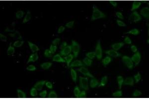 Immunofluorescence analysis of HeLa cells using DNM1 Polyclonal Antibody (Dynamin 1 抗体)