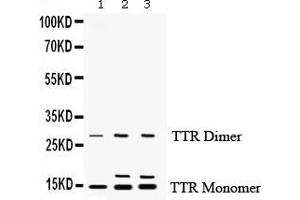 Western Blotting (WB) image for anti-Transthyretin (TTR) (AA 21-147) antibody (ABIN3042346)