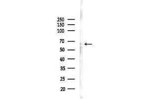 Western blot analysis of lysates from COLO205 cells(heat-shock,45 min treatment), using LARP7 Antibody at 1/1000 dilution.