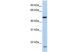 WB Suggested Anti-ZNF764 Antibody Titration:  0. (ZNF764 抗体  (N-Term))