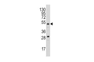 Western blot analysis of anti-PLAU Antibody (N-term) (ABIN1882148 and ABIN2842233) in  cell line lysates (35 μg/lane). (PLAU 抗体  (N-Term))